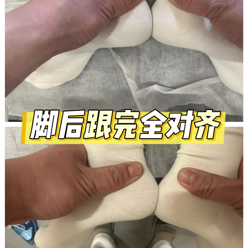 改善O型腿 