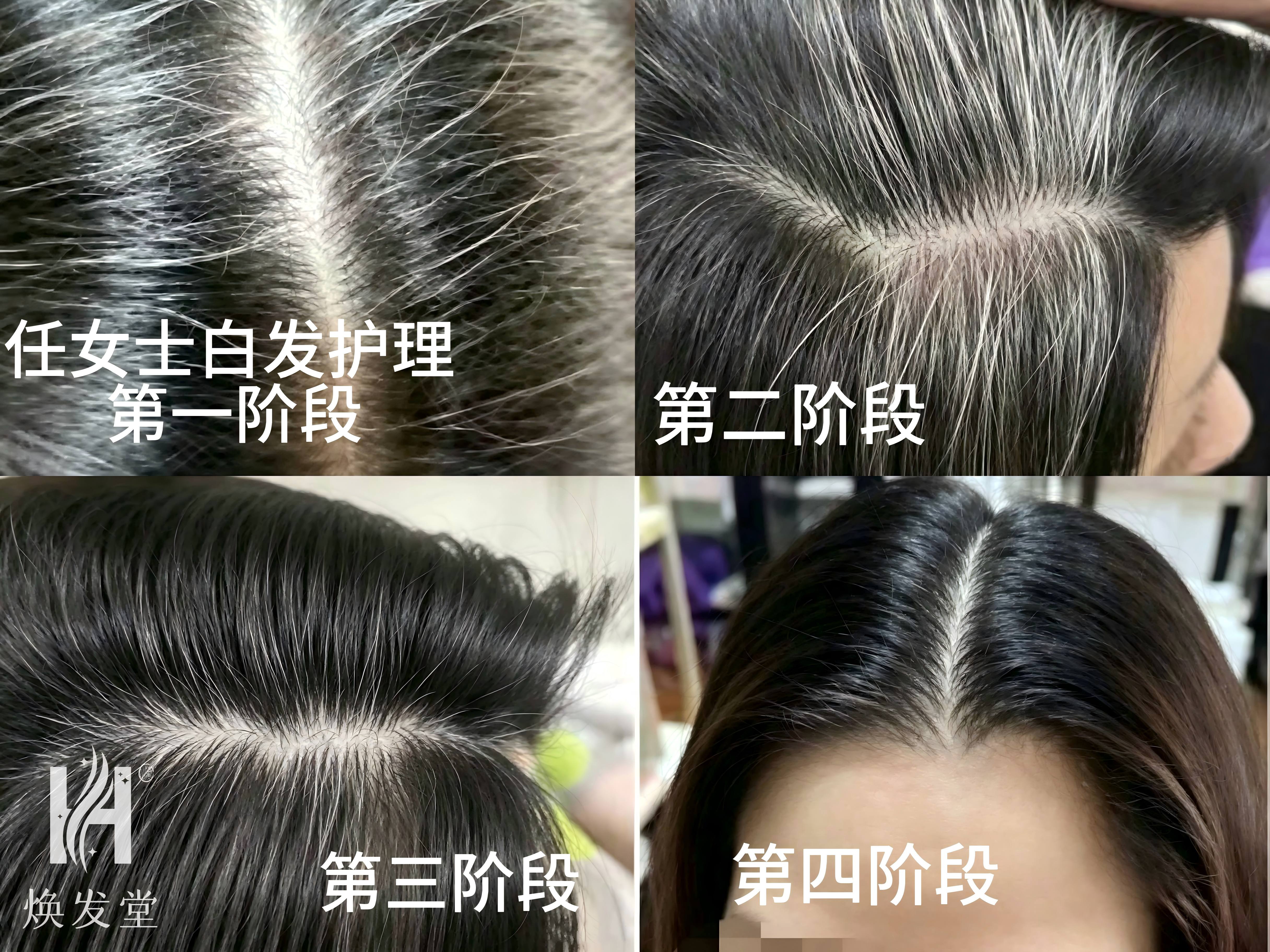 发丝发白专项护理