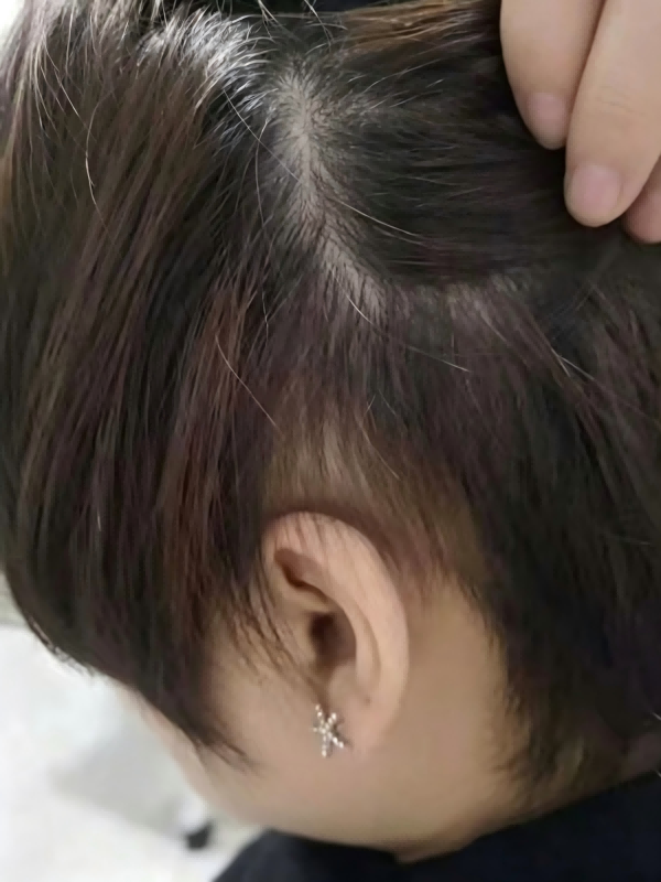 头皮养护服务实拍