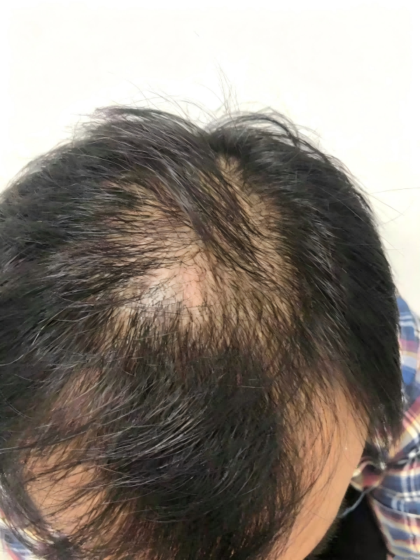 护理实拍