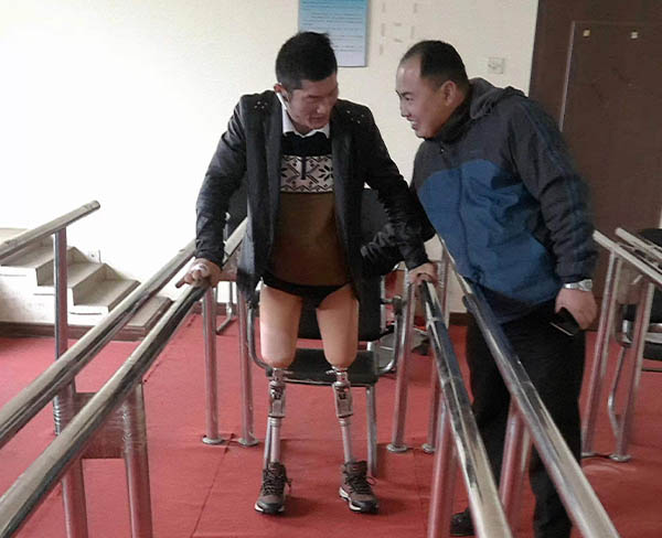 假肢装配案例